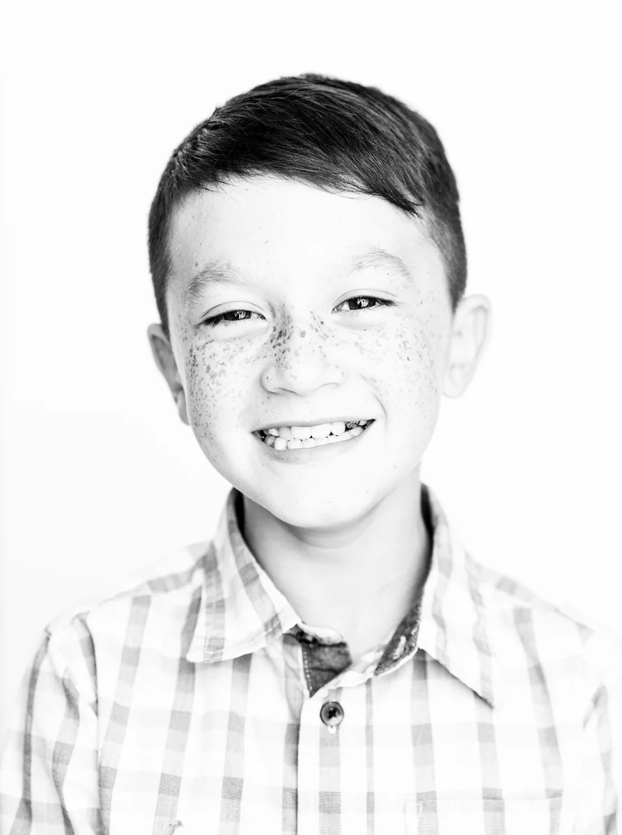 Oasis Orthodontics patient, Early Treatment (Phase 1)